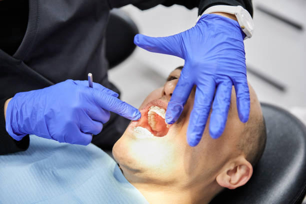 Best Chipped Tooth Repair Near Me  in Muscatine, IA